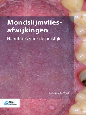 cover image of Mondslijmvliesafwijkingen